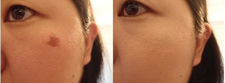 24hコンシーラUV2