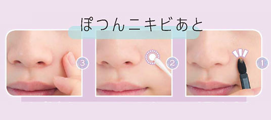 ニキビあと メイク