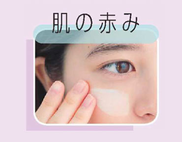 肌の赤み 隠すメイク