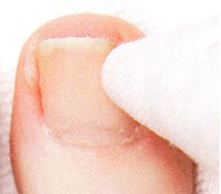 足爪ケア6