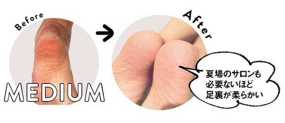 サンダル かかとケア