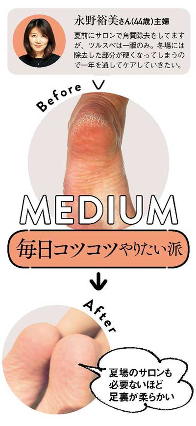 サンダル かかとケア