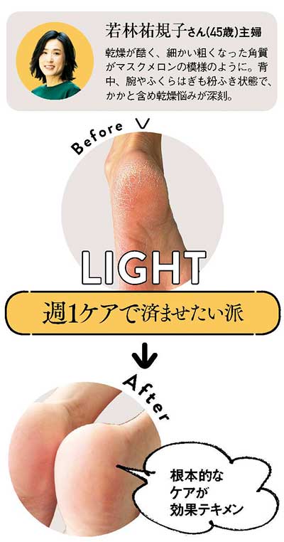 サンダル フットケア