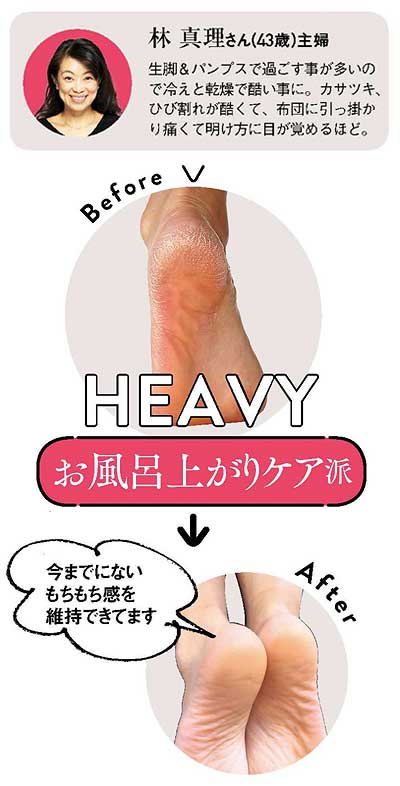 40代 かかとケア