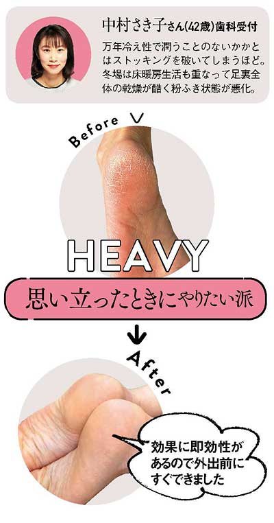 30代 かかとケア