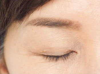 60代 二重テープ2