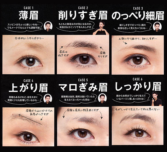 眉毛 悩み